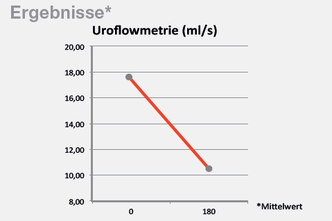 Uroflowmetrie